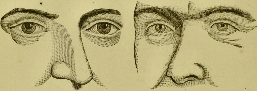 An illustration from A system of practical and scientific physiognomy, or, How to read faces : being a manual of instruction in the knowledge of the human physiognomy and organism, embracing the discoveries of located signs of character in the body and face, as shown by the five natural divisions of the countenance. Volume 2 / by Mary Olmstead Stanton., 1890, leaf 400