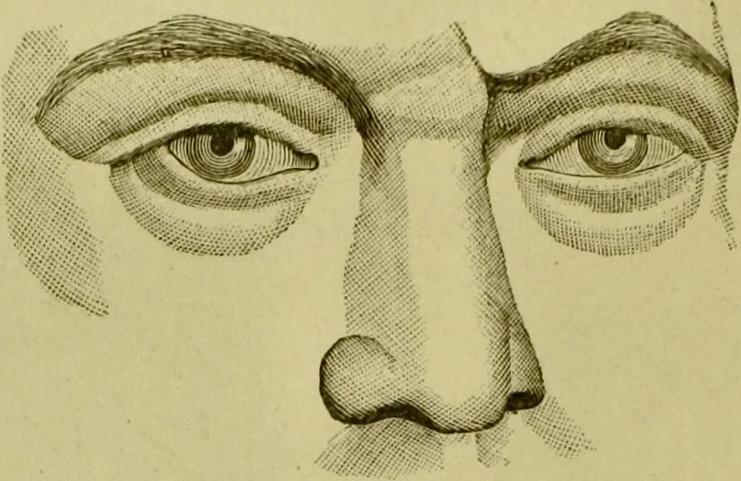 An illustration from A system of practical and scientific physiognomy, or, How to read faces : being a manual of instruction in the knowledge of the human physiognomy and organism, embracing the discoveries of located signs of character in the body and face, as shown by the five natural divisions of the countenance. Volume 2 / by Mary Olmstead Stanton., 1890, leaf 404