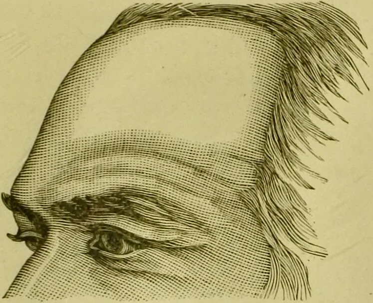 An illustration from A system of practical and scientific physiognomy, or, How to read faces : being a manual of instruction in the knowledge of the human physiognomy and organism, embracing the discoveries of located signs of character in the body and face, as shown by the five natural divisions of the countenance. Volume 2 / by Mary Olmstead Stanton., 1890, leaf 411