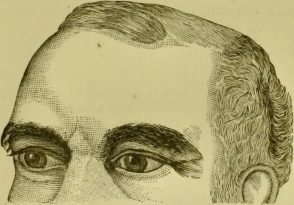 An illustration from A system of practical and scientific physiognomy, or, How to read faces : being a manual of instruction in the knowledge of the human physiognomy and organism, embracing the discoveries of located signs of character in the body and face, as shown by the five natural divisions of the countenance. Volume 2 / by Mary Olmstead Stanton., 1890, leaf 413