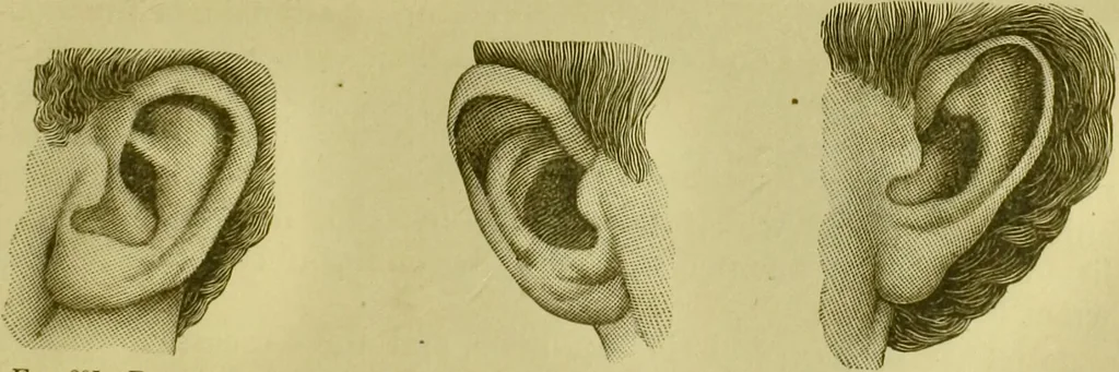 An illustration from A system of practical and scientific physiognomy, or, How to read faces : being a manual of instruction in the knowledge of the human physiognomy and organism, embracing the discoveries of located signs of character in the body and face, as shown by the five natural divisions of the countenance. Volume 2 / by Mary Olmstead Stanton., 1890, leaf 449