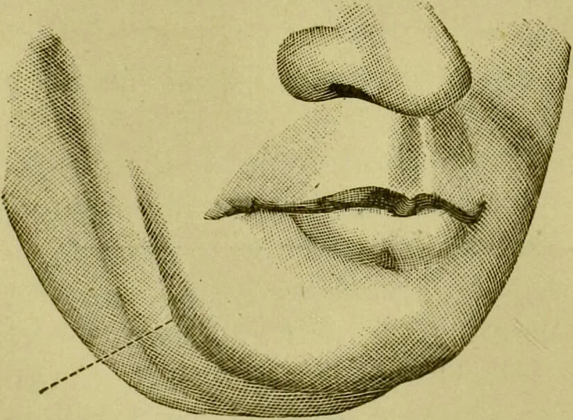 An illustration from A system of practical and scientific physiognomy, or, How to read faces : being a manual of instruction in the knowledge of the human physiognomy and organism, embracing the discoveries of located signs of character in the body and face, as shown by the five natural divisions of the countenance. Volume 2 / by Mary Olmstead Stanton., 1890, leaf 458