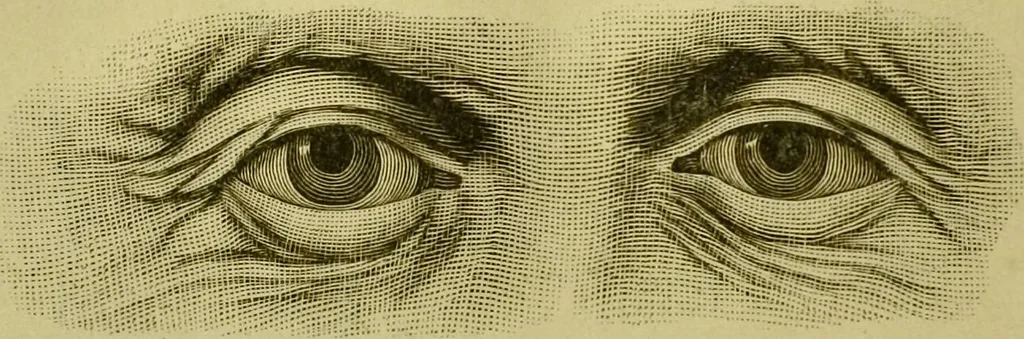 An illustration from A system of practical and scientific physiognomy, or, How to read faces : being a manual of instruction in the knowledge of the human physiognomy and organism, embracing the discoveries of located signs of character in the body and face, as shown by the five natural divisions of the countenance. Volume 2 / by Mary Olmstead Stanton., 1890, leaf 462