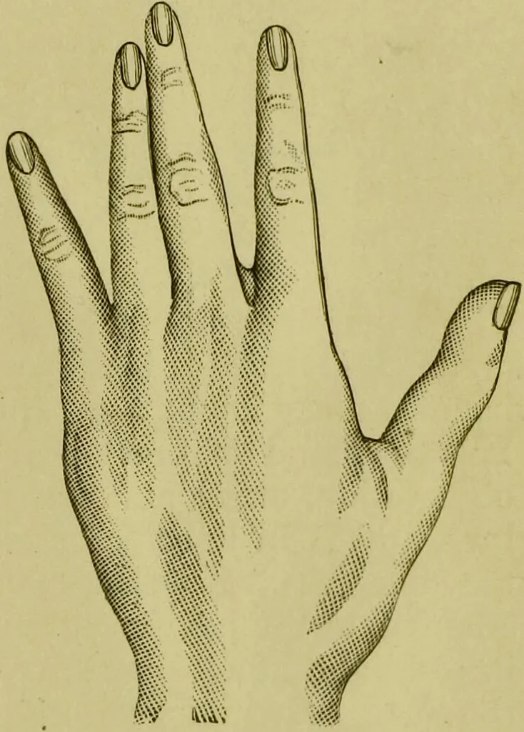 An illustration from A system of practical and scientific physiognomy, or, How to read faces : being a manual of instruction in the knowledge of the human physiognomy and organism, embracing the discoveries of located signs of character in the body and face, as shown by the five natural divisions of the countenance. Volume 2 / by Mary Olmstead Stanton., 1890, leaf 497