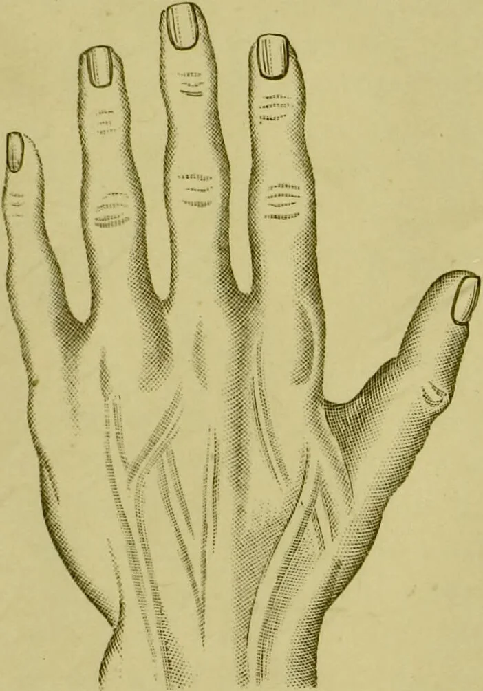 An illustration from A system of practical and scientific physiognomy, or, How to read faces : being a manual of instruction in the knowledge of the human physiognomy and organism, embracing the discoveries of located signs of character in the body and face, as shown by the five natural divisions of the countenance. Volume 2 / by Mary Olmstead Stanton., 1890, leaf 499