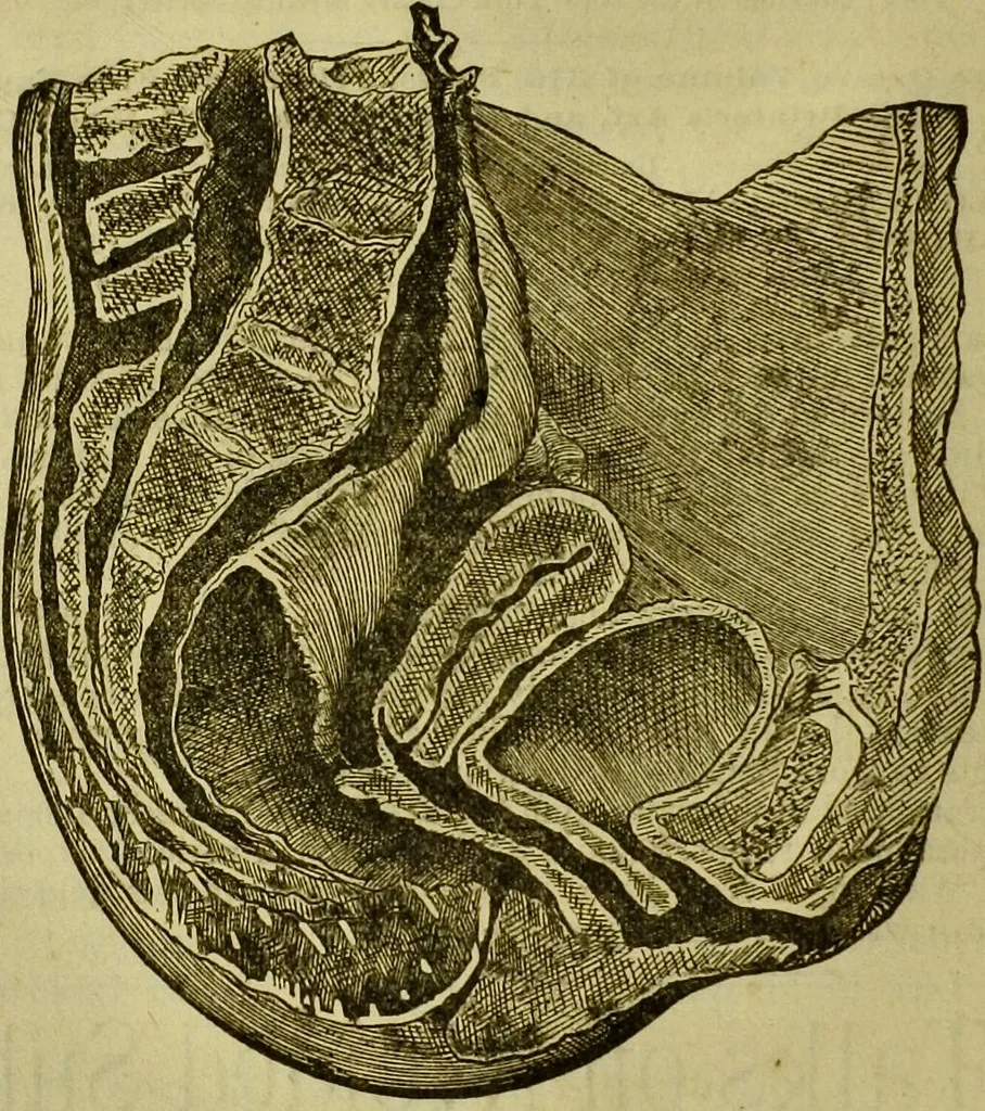 An illustration from A system of practical and scientific physiognomy, or, How to read faces : being a manual of instruction in the knowledge of the human physiognomy and organism, embracing the discoveries of located signs of character in the body and face, as shown by the five natural divisions of the countenance. Volume 2 / by Mary Olmstead Stanton., 1890, leaf 652