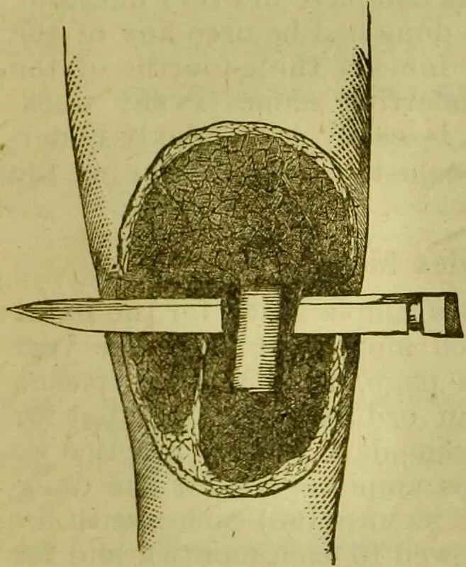 An illustration from A system of practical and scientific physiognomy, or, How to read faces : being a manual of instruction in the knowledge of the human physiognomy and organism, embracing the discoveries of located signs of character in the body and face, as shown by the five natural divisions of the countenance. Volume 2 / by Mary Olmstead Stanton., 1890, leaf 657