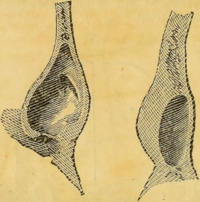 An illustration from Manual of phrenology : as an accompaniment to the phrenological bust., 1828, leaf 38