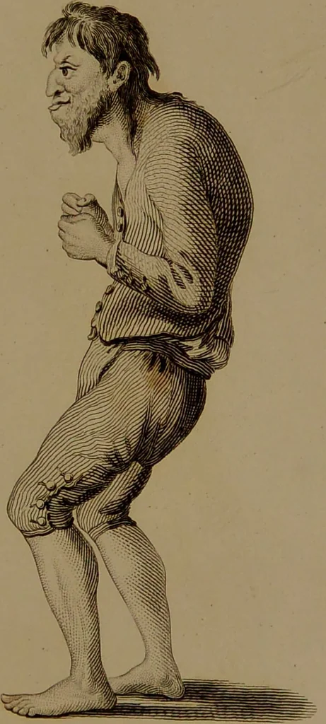 An illustration from Essays on physiognomy : designed to promote the knowledge and the love of mankind / written in the German language by John Caspar Lavater ; and translated into English by Thomas Holcroft ; to which are added one hundred physiognomonical rules, a posthumous work by Mr. Lavater and Memoirs of the life of the author compiled principally from The Life of Lavater, by G. Gessner., 1850, leaf 265