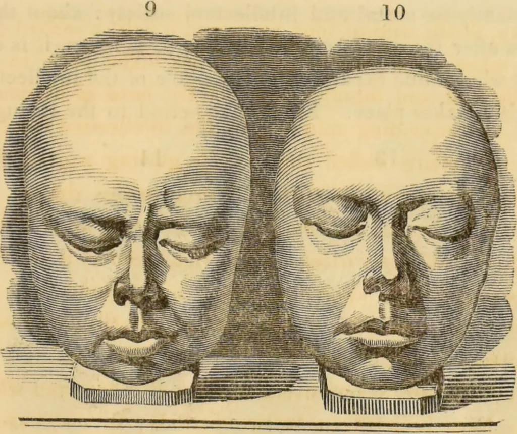 An illustration from Manual of phrenology : as an accompaniment to the phrenological bust / [James De Ville]., 1835, leaf 111