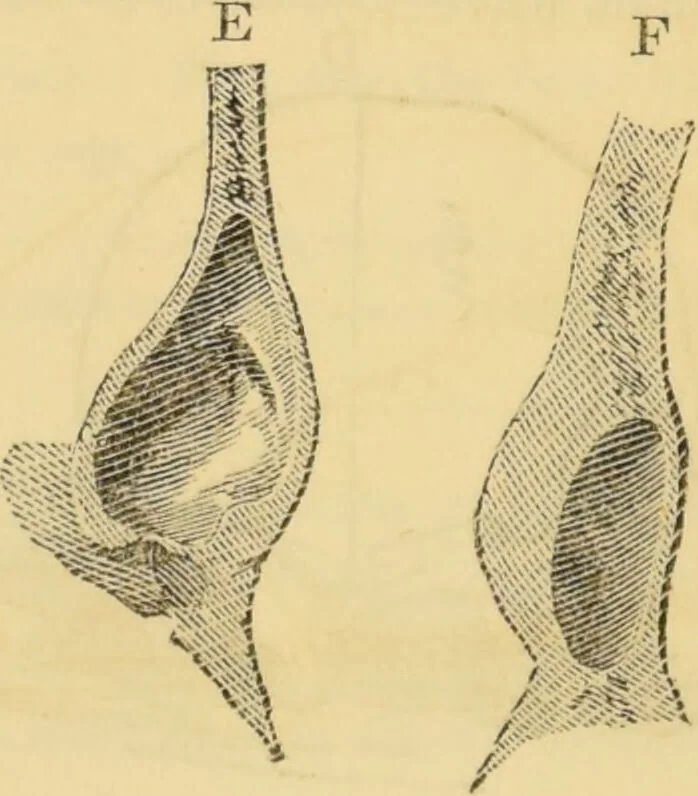 An illustration from Manual of phrenology : as an accompaniment to the phrenological bust / [James De Ville]., 1835, leaf 42