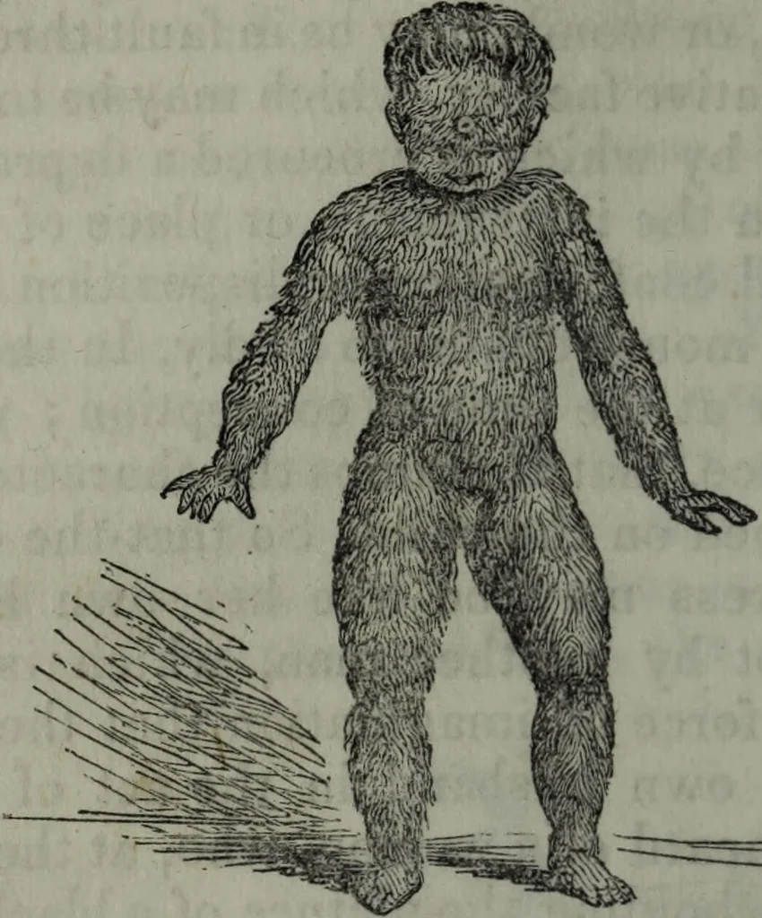 An illustration from The midwife's guide : being the complete works of Aristotle : beautifully illustrated. To which is added an appendix, explanatory of the illustrations, never before published., 1845, leaf 40