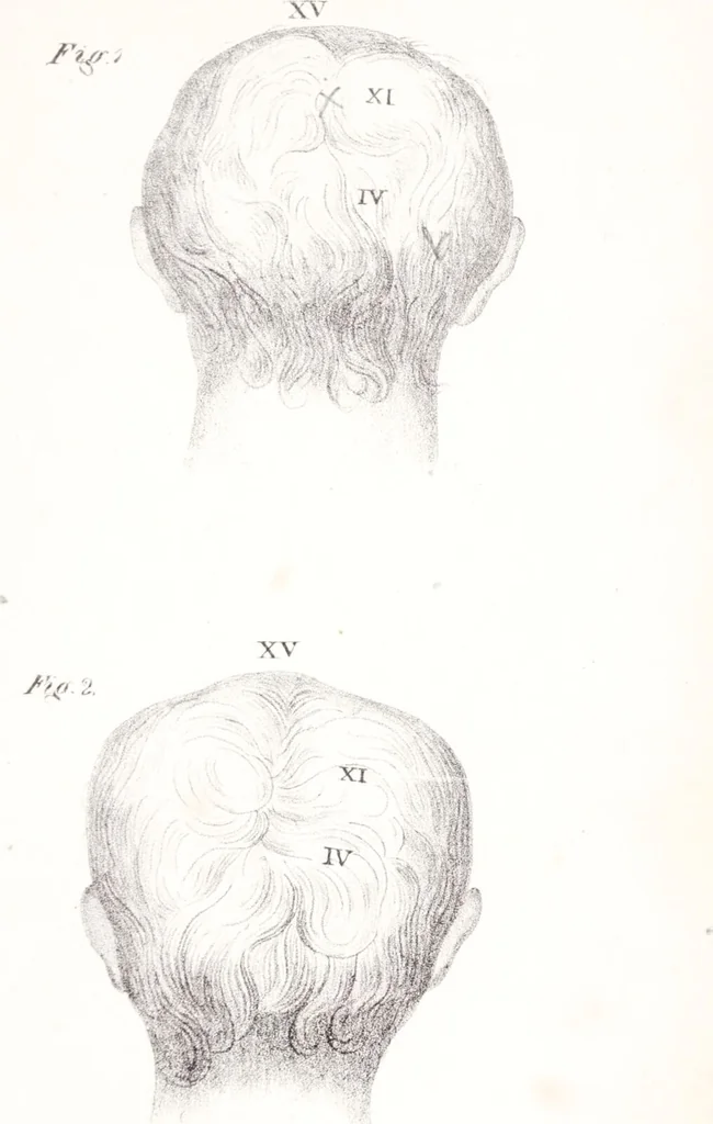 An illustration from Phrenology, or the doctrine of the mind : and of the relations between its manifestations and the body., 1825, leaf 329