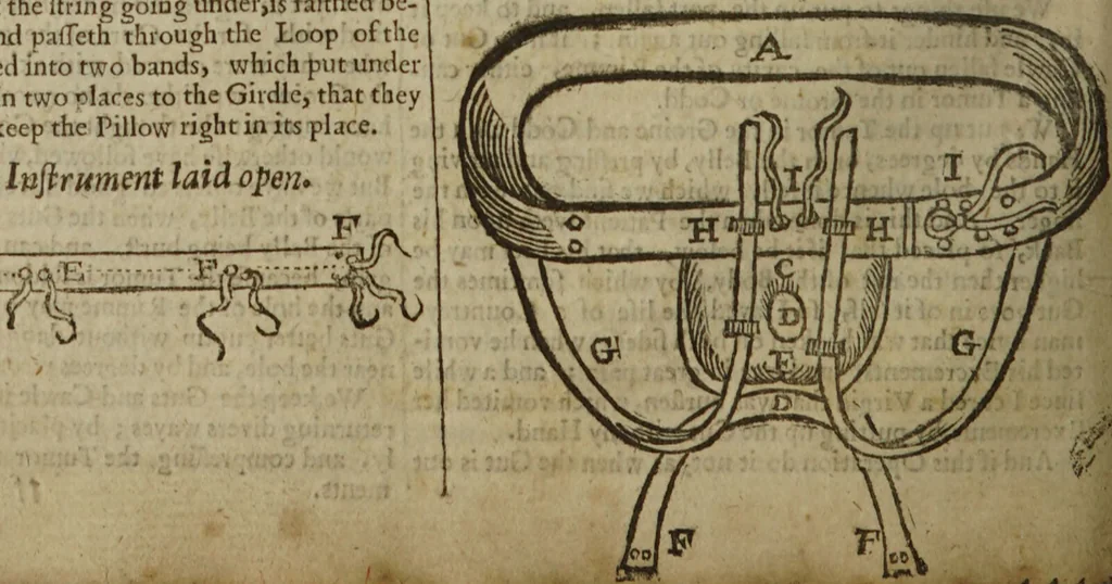 An illustration from Platerus Golden practice of physick : Fully and plainly discovering, I. All the kinds. II. The several causes of every disease. III. Their most proper cures ... In three books, and five tomes, or parts. Being the fruits of one and thirty years travel: and fifty years practice of physick / By Felix Plater, Abdiah Cole, Nich. Culpeper., 1664, leaf 498