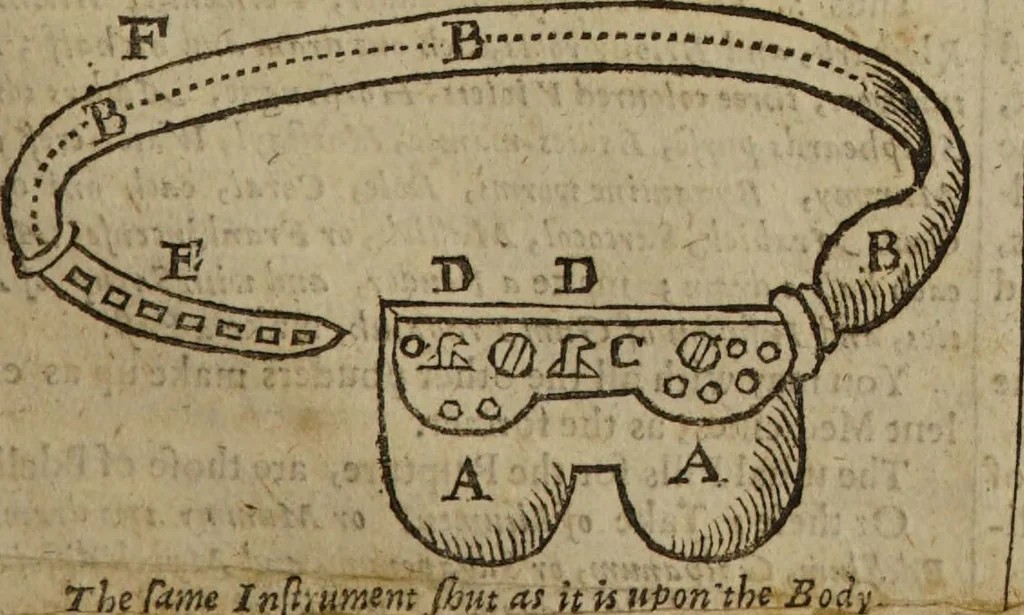 An illustration from Platerus Golden practice of physick : Fully and plainly discovering, I. All the kinds. II. The several causes of every disease. III. Their most proper cures ... In three books, and five tomes, or parts. Being the fruits of one and thirty years travel: and fifty years practice of physick / By Felix Plater, Abdiah Cole, Nich. Culpeper., 1664, leaf 499