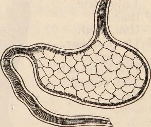 An illustration from The confessional ... An analysis of the causes and cure of melancholy, nervousness, mental and physical debility, arising from ill health, worldly anxiety ... To which is added an essay on corpulency-obesity ... A sketch of choice in marriage, phrenologically considered ... and a few comments on drunkenness / [Robert James Culverwell]., 1841, leaf 19