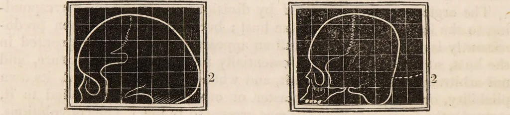 An illustration from Outlines of phrenology / [George Combe]., 1835, leaf 14