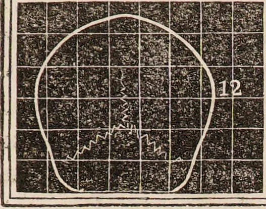 An illustration from Outlines of phrenology / [George Combe]., 1835, leaf 19
