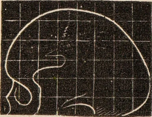 An illustration from Outlines of phrenology / [George Combe]., 1838, leaf 18