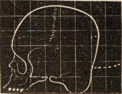 An illustration from Outlines of phrenology / [George Combe]., 1838, leaf 18