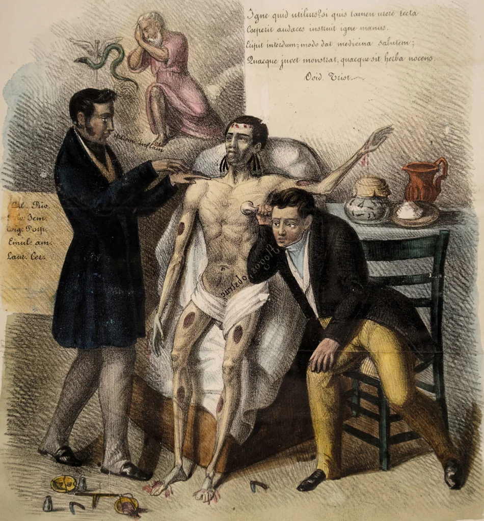 An illustration from Memoria di spontanea e singolare guarigione di un' aneurisma della femorale primitiva : osservato dalla maggior parte de' chirurgi, e medici degl' incurabili / scritta da Francesco Calise, chirurgo ordinario dell' ospedale suddetto., 1842, leaf 37
