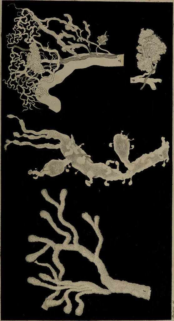 An illustration from Die Gebärmutter und das Ei des Menschen in den ersten Schwangerschaftsmonaten : nach der Natur dargestellt / von Burkhard Wilhelm Seiler. Mit zwölf Kupfertafeln., 1832, leaf 69