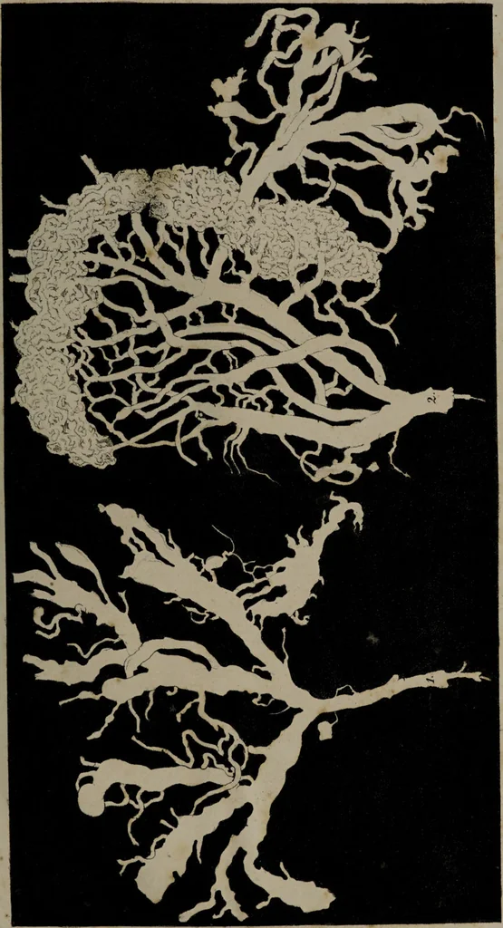 An illustration from Die Gebärmutter und das Ei des Menschen in den ersten Schwangerschaftsmonaten : nach der Natur dargestellt / von Burkhard Wilhelm Seiler. Mit zwölf Kupfertafeln., 1832, leaf 71