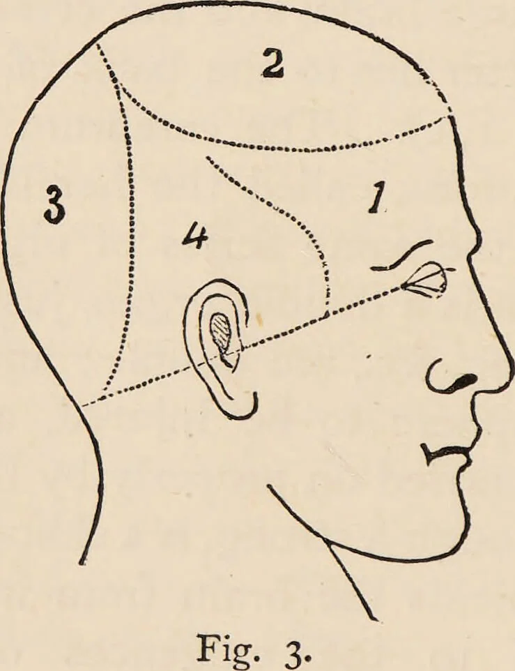 An illustration from How to learn phrenology : with hints as to the study of character / by L.N. Fowler., 1886, leaf 12