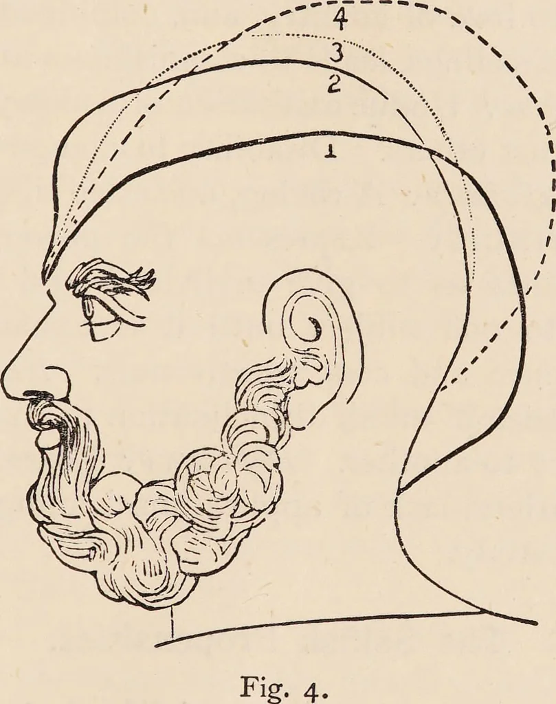 An illustration from How to learn phrenology : with hints as to the study of character / by L.N. Fowler., 1886, leaf 13
