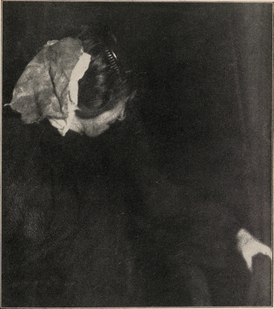 An illustration from Phenomena of materialisation : a contribution to the investigation of mediumistic teleplastics / by Baron von Schrenck Notzing ; translated by E.E. Fournier d'Albe., 1923, leaf 185