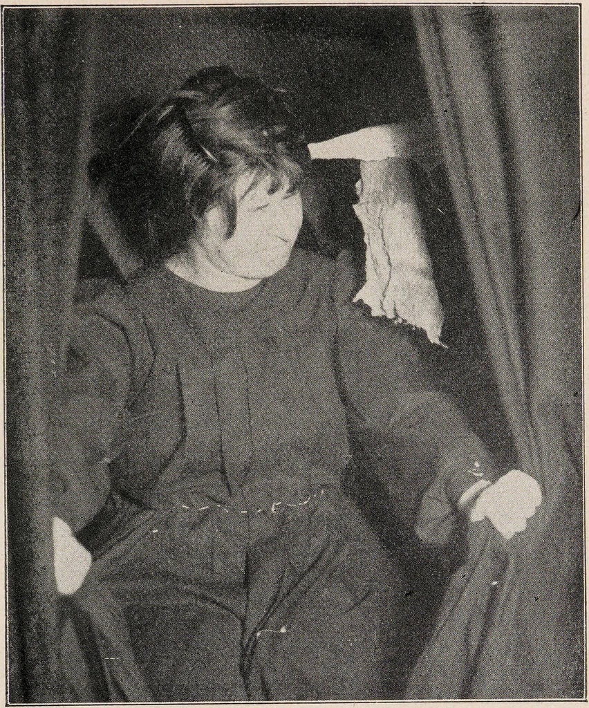 An illustration from Phenomena of materialisation : a contribution to the investigation of mediumistic teleplastics / by Baron von Schrenck Notzing ; translated by E.E. Fournier d'Albe., 1923, leaf 199