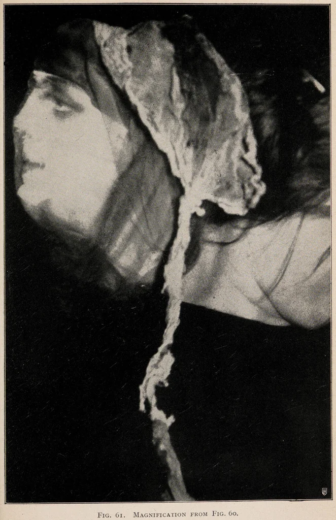 An illustration from Phenomena of materialisation : a contribution to the investigation of mediumistic teleplastics / by Baron von Schrenck Notzing ; translated by E.E. Fournier d'Albe., 1923, leaf 203