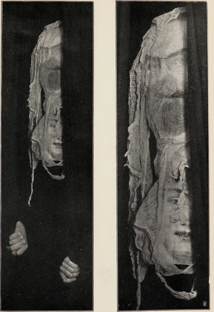 An illustration from Phenomena of materialisation : a contribution to the investigation of mediumistic teleplastics / by Baron von Schrenck Notzing ; translated by E.E. Fournier d'Albe., 1923, leaf 249