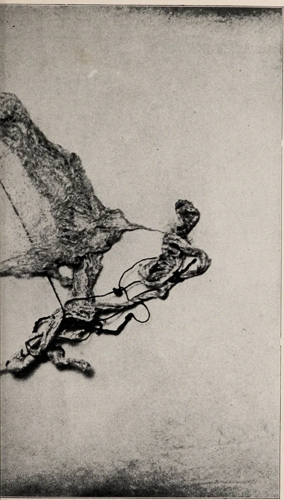 An illustration from Phenomena of materialisation : a contribution to the investigation of mediumistic teleplastics / by Baron von Schrenck Notzing ; translated by E.E. Fournier d'Albe., 1923, leaf 333