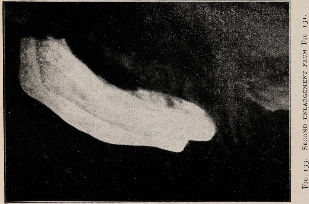 An illustration from Phenomena of materialisation : a contribution to the investigation of mediumistic teleplastics / by Baron von Schrenck Notzing ; translated by E.E. Fournier d'Albe., 1923, leaf 338