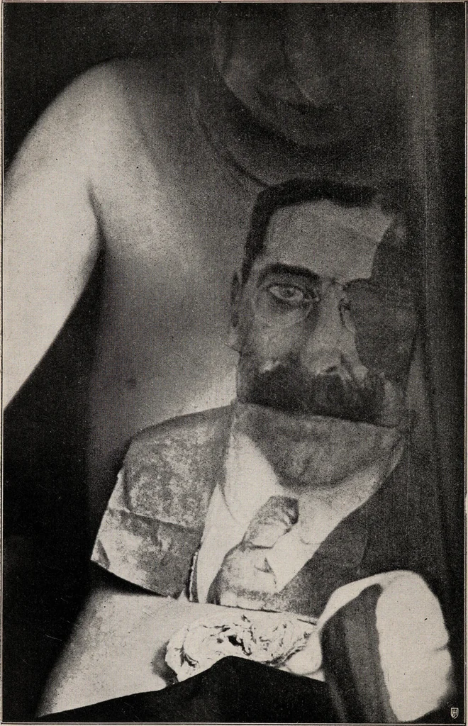 An illustration from Phenomena of materialisation : a contribution to the investigation of mediumistic teleplastics / by Baron von Schrenck Notzing ; translated by E.E. Fournier d'Albe., 1923, leaf 340