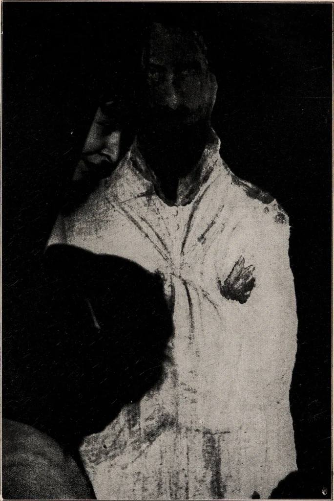 An illustration from Phenomena of materialisation : a contribution to the investigation of mediumistic teleplastics / by Baron von Schrenck Notzing ; translated by E.E. Fournier d'Albe., 1923, leaf 361