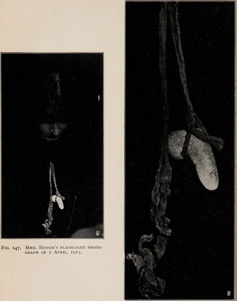 An illustration from Phenomena of materialisation : a contribution to the investigation of mediumistic teleplastics / by Baron von Schrenck Notzing ; translated by E.E. Fournier d'Albe., 1923, leaf 362