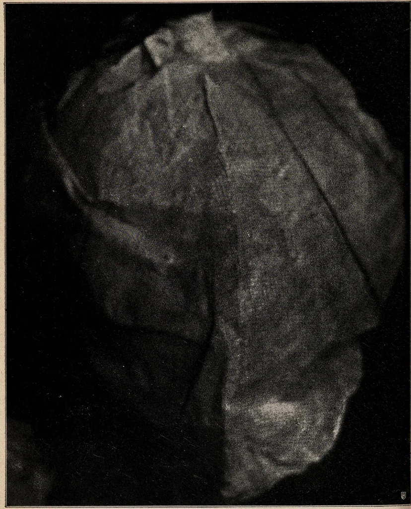 An illustration from Phenomena of materialisation : a contribution to the investigation of mediumistic teleplastics / by Baron von Schrenck Notzing ; translated by E.E. Fournier d'Albe., 1923, leaf 376