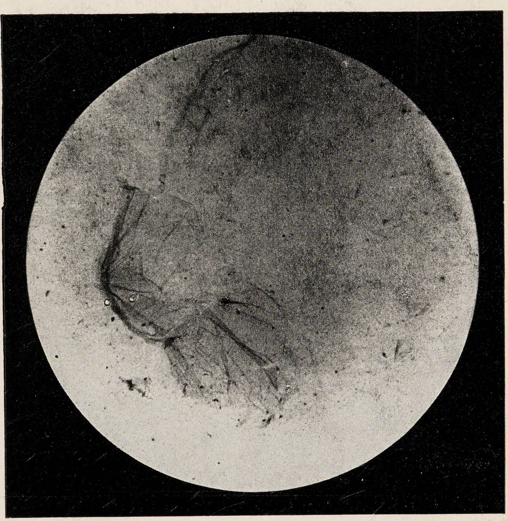An illustration from Phenomena of materialisation : a contribution to the investigation of mediumistic teleplastics / by Baron von Schrenck Notzing ; translated by E.E. Fournier d'Albe., 1923, leaf 391