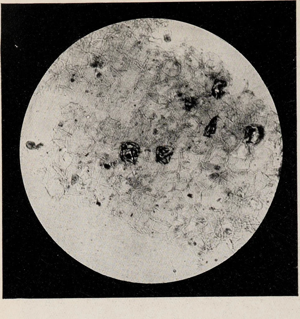 An illustration from Phenomena of materialisation : a contribution to the investigation of mediumistic teleplastics / by Baron von Schrenck Notzing ; translated by E.E. Fournier d'Albe., 1923, leaf 392