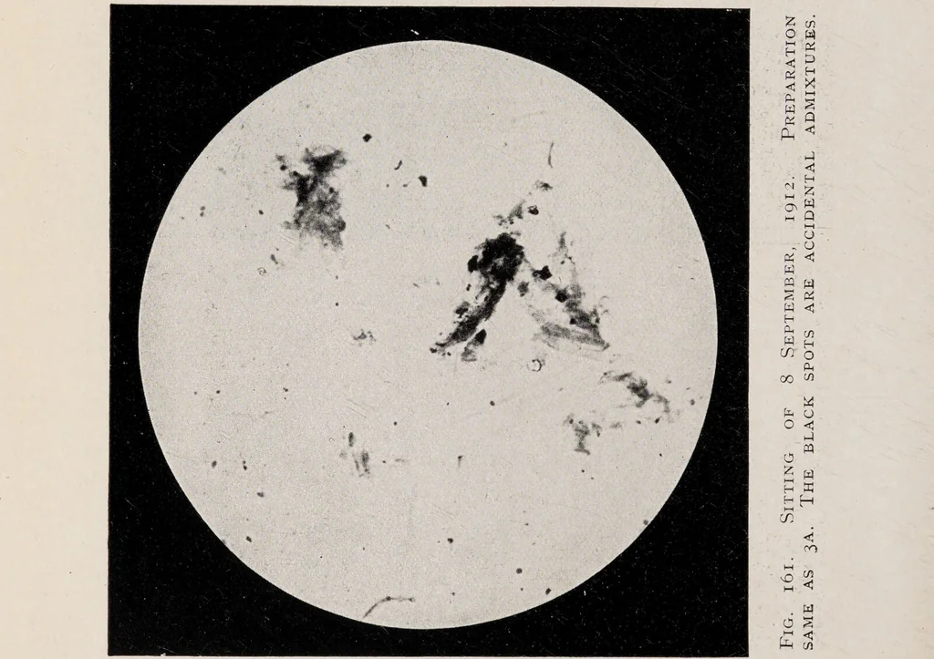 An illustration from Phenomena of materialisation : a contribution to the investigation of mediumistic teleplastics / by Baron von Schrenck Notzing ; translated by E.E. Fournier d'Albe., 1923, leaf 392
