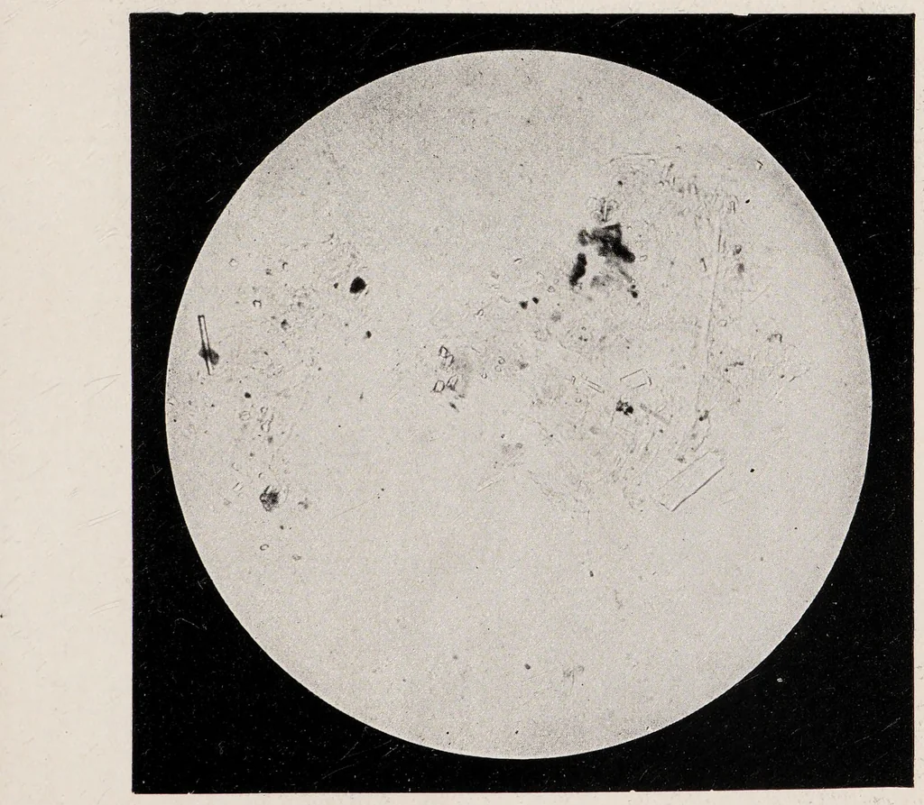 An illustration from Phenomena of materialisation : a contribution to the investigation of mediumistic teleplastics / by Baron von Schrenck Notzing ; translated by E.E. Fournier d'Albe., 1923, leaf 393