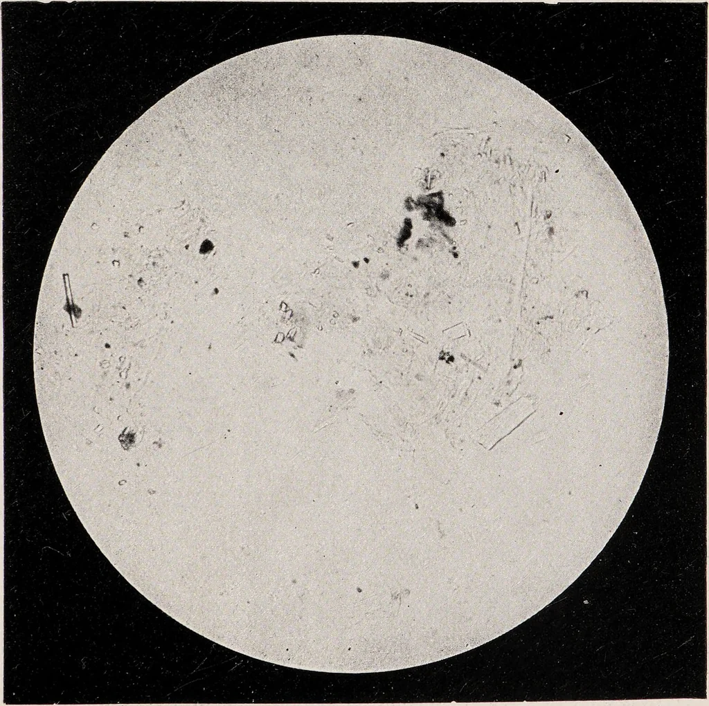 An illustration from Phenomena of materialisation : a contribution to the investigation of mediumistic teleplastics / by Baron von Schrenck Notzing ; translated by E.E. Fournier d'Albe., 1923, leaf 393