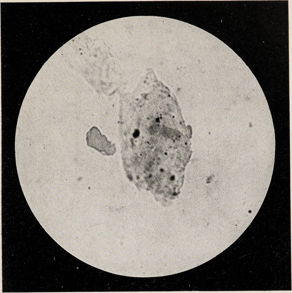 An illustration from Phenomena of materialisation : a contribution to the investigation of mediumistic teleplastics / by Baron von Schrenck Notzing ; translated by E.E. Fournier d'Albe., 1923, leaf 393