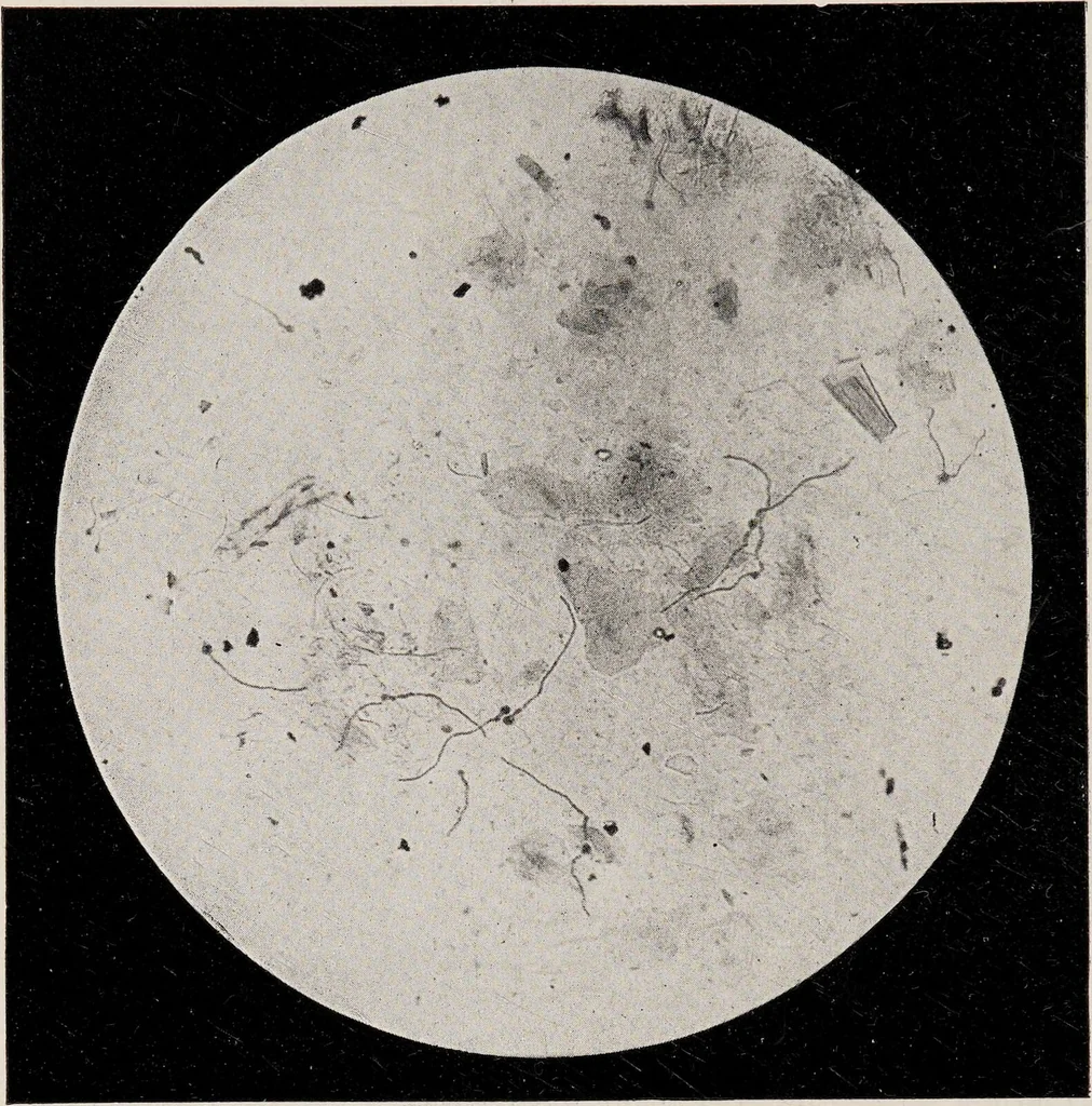 An illustration from Phenomena of materialisation : a contribution to the investigation of mediumistic teleplastics / by Baron von Schrenck Notzing ; translated by E.E. Fournier d'Albe., 1923, leaf 394