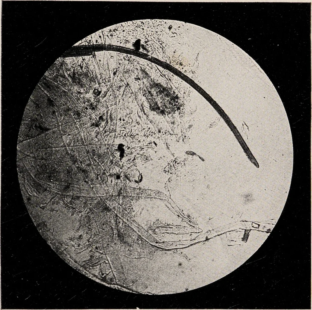 An illustration from Phenomena of materialisation : a contribution to the investigation of mediumistic teleplastics / by Baron von Schrenck Notzing ; translated by E.E. Fournier d'Albe., 1923, leaf 397