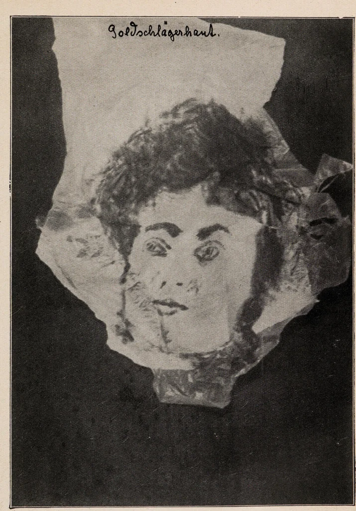 An illustration from Phenomena of materialisation : a contribution to the investigation of mediumistic teleplastics / by Baron von Schrenck Notzing ; translated by E.E. Fournier d'Albe., 1923, leaf 453