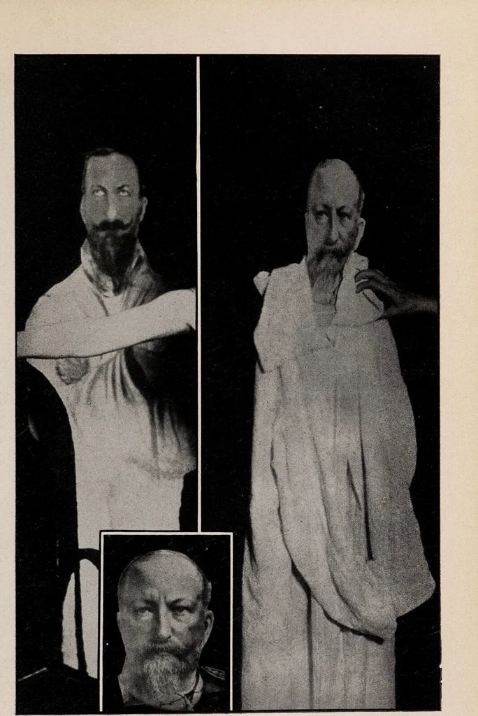 An illustration from Phenomena of materialisation : a contribution to the investigation of mediumistic teleplastics / by Baron von Schrenck Notzing ; translated by E.E. Fournier d'Albe., 1923, leaf 467