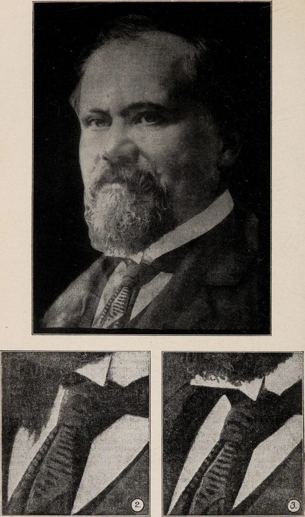 An illustration from Phenomena of materialisation : a contribution to the investigation of mediumistic teleplastics / by Baron von Schrenck Notzing ; translated by E.E. Fournier d'Albe., 1923, leaf 474
